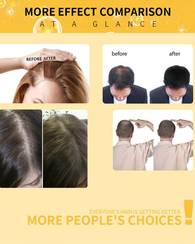 Damaged Hair Repair Women Men's Fast Hair Growth Essence Oil Anti-hair Loss Lotion