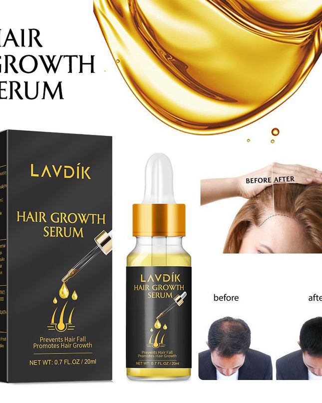 Damaged Hair Repair Women Men's Fast Hair Growth Essence Oil Anti-hair Loss Lotion